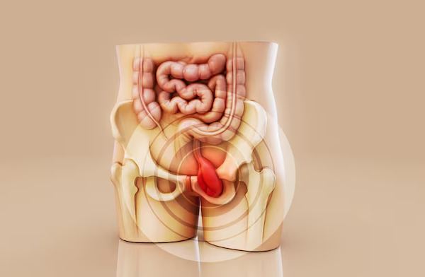Abdominal Hernias