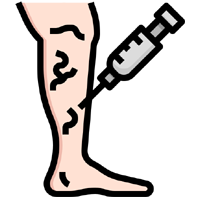 Varicose Veins 